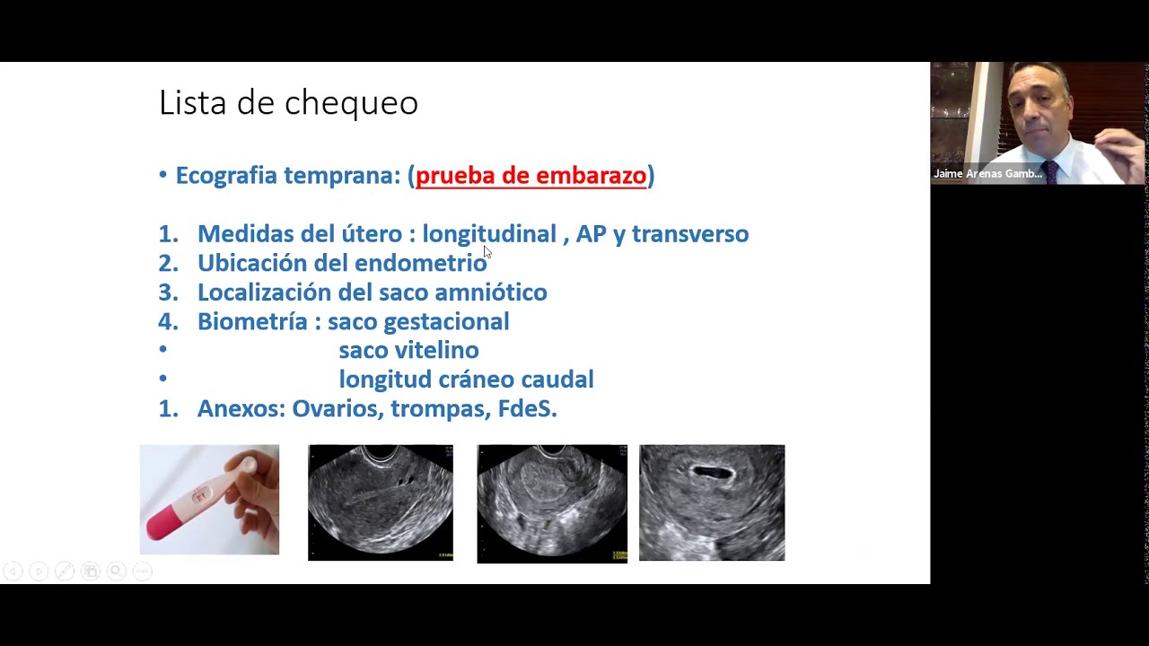 Tamizaje de Primer Trimestre | Webinar Promedco Mindray