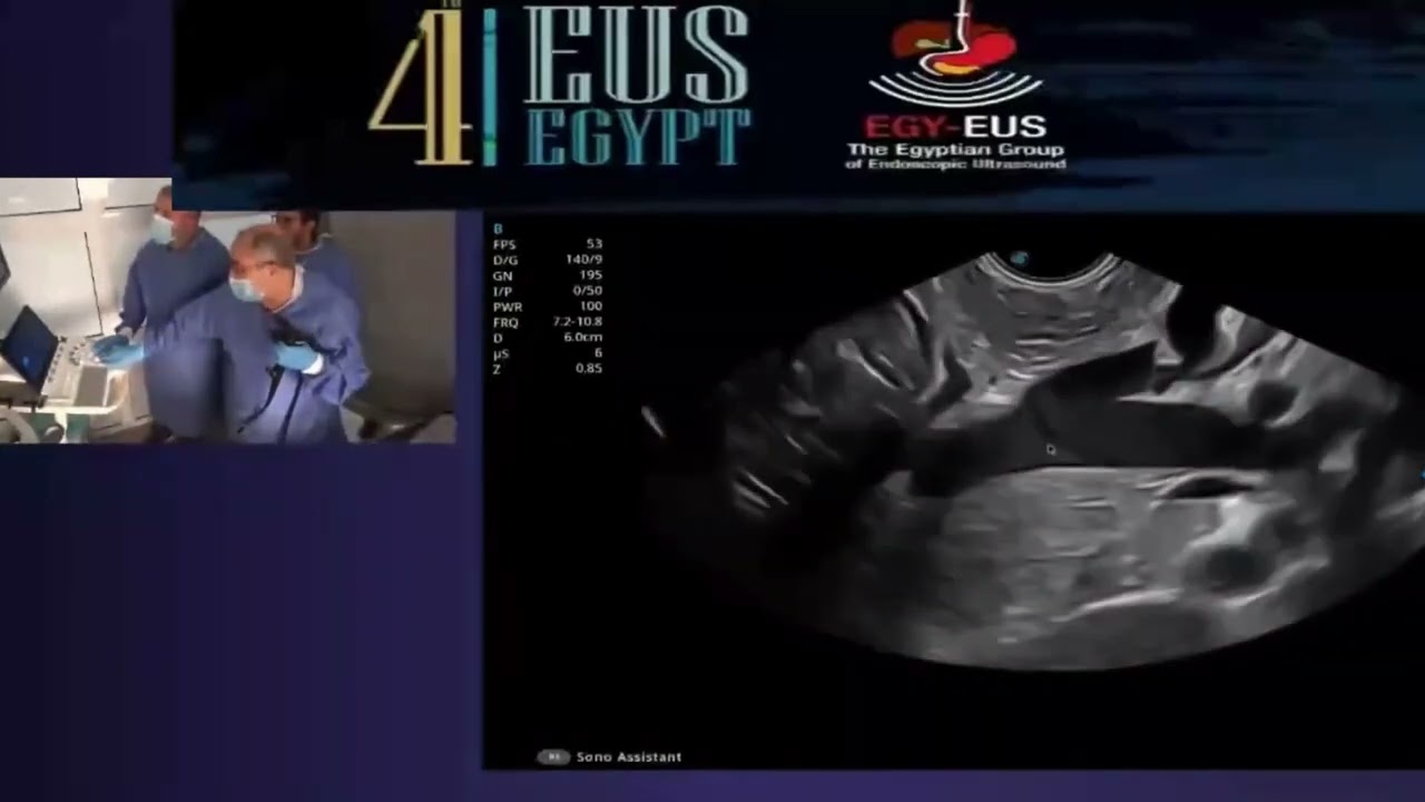 4th EUS Egypt   Linear EUS Examination of the Pancreas from the Stomach