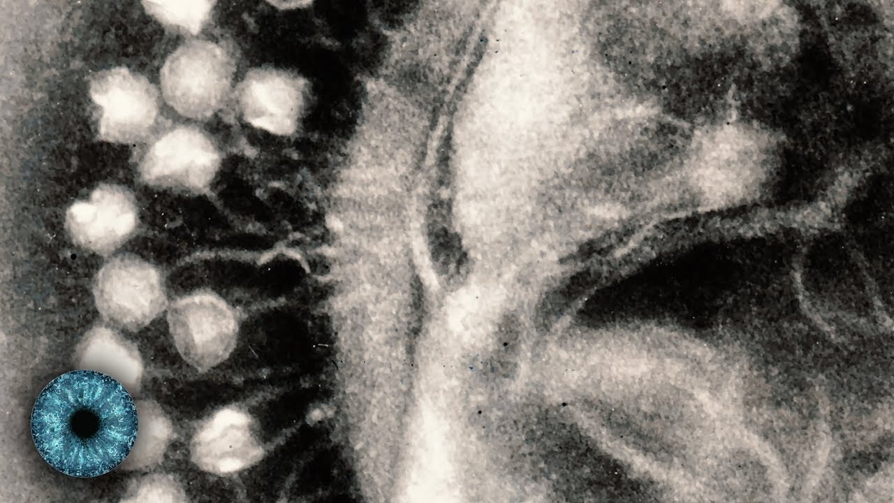 Antibiotika-Resistenzen: Können Phagen Millionen vor dem sicheren Tod retten?
