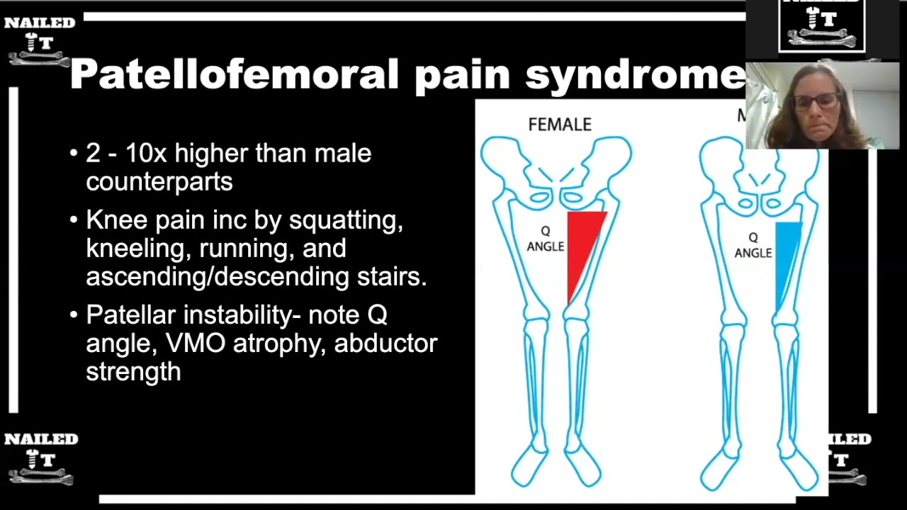 Risk factors for sports injuries in female athletes