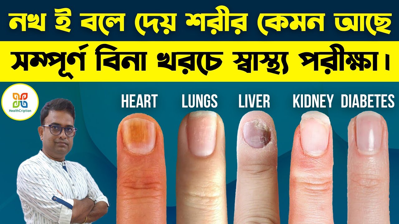 আপানার নখ দেখলেই বুঝতে পারবেন শরীরে কোন রোগ বাসা বেঁধেছে কিনা ? Nail Signs of Deficiency & Disease.
