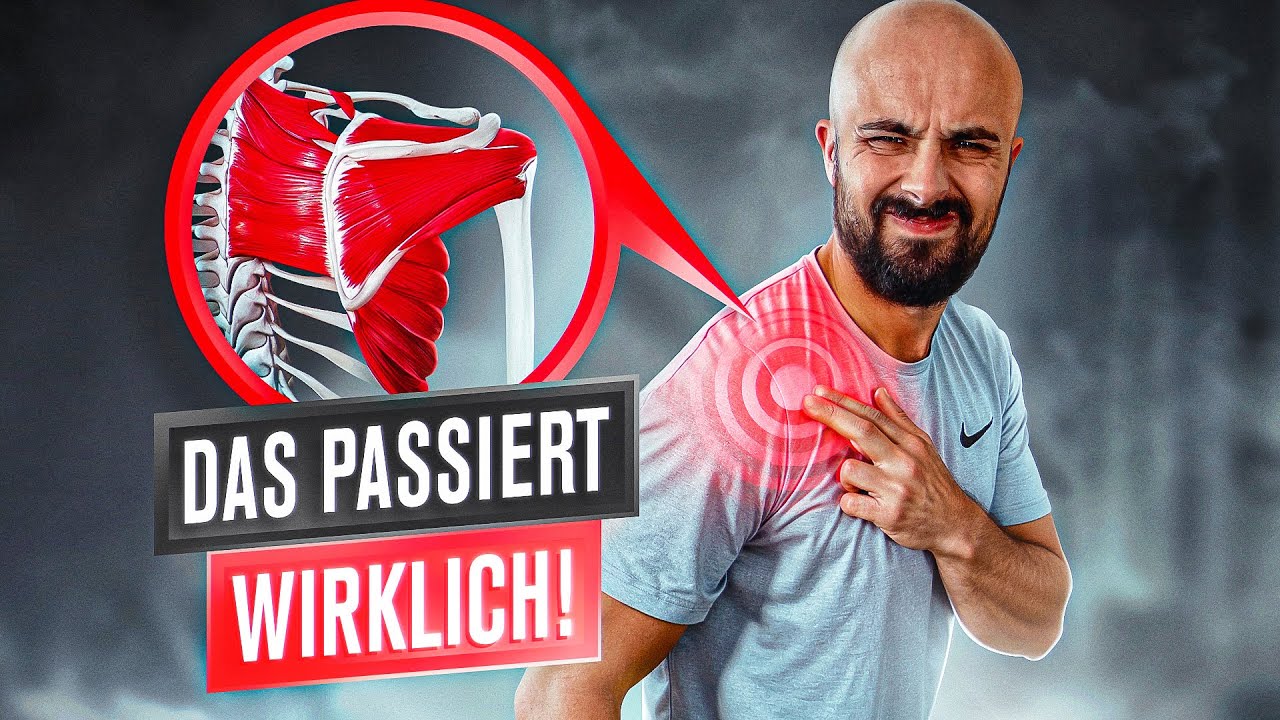 Schulterschmerzen (sind keine Arthrose} | 2 Übungen gegen die Ursache