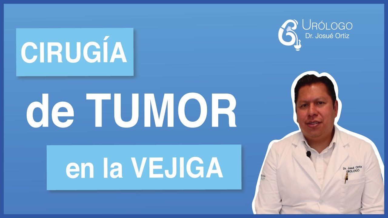 CIRUG&Iacute;A de TUMOR en la VEJIGA - UR&Oacute;LOGO Josu&eacute; Ort&iacute;z