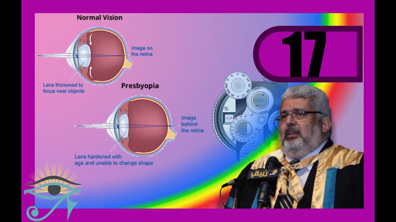017 ]Dr El Kafrawy Optics[Presbyobia