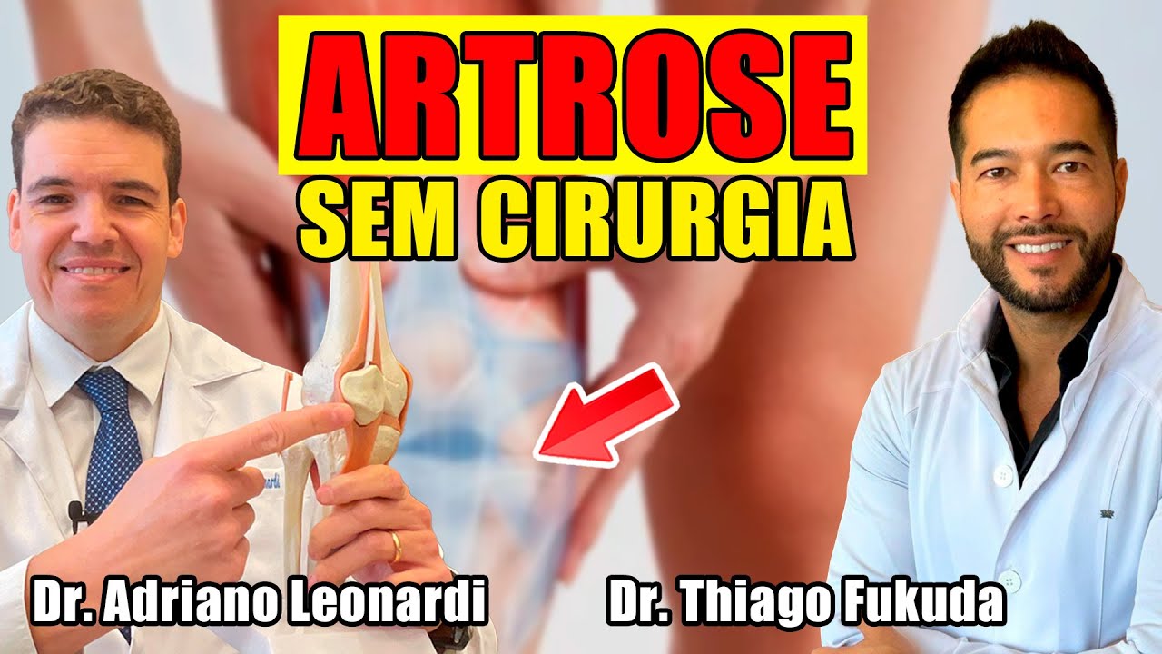 Tratamento da artrose sem cirurgia [Live] #12
