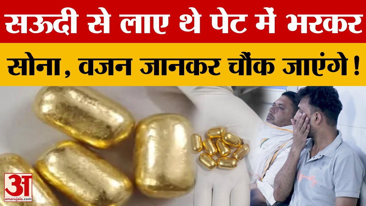 Moradabad: सऊदी से लौटे लोगों के पेट से निकला सोना, डॉक्टरों ने निकाले 25 से ज्यादा कैप्सूल