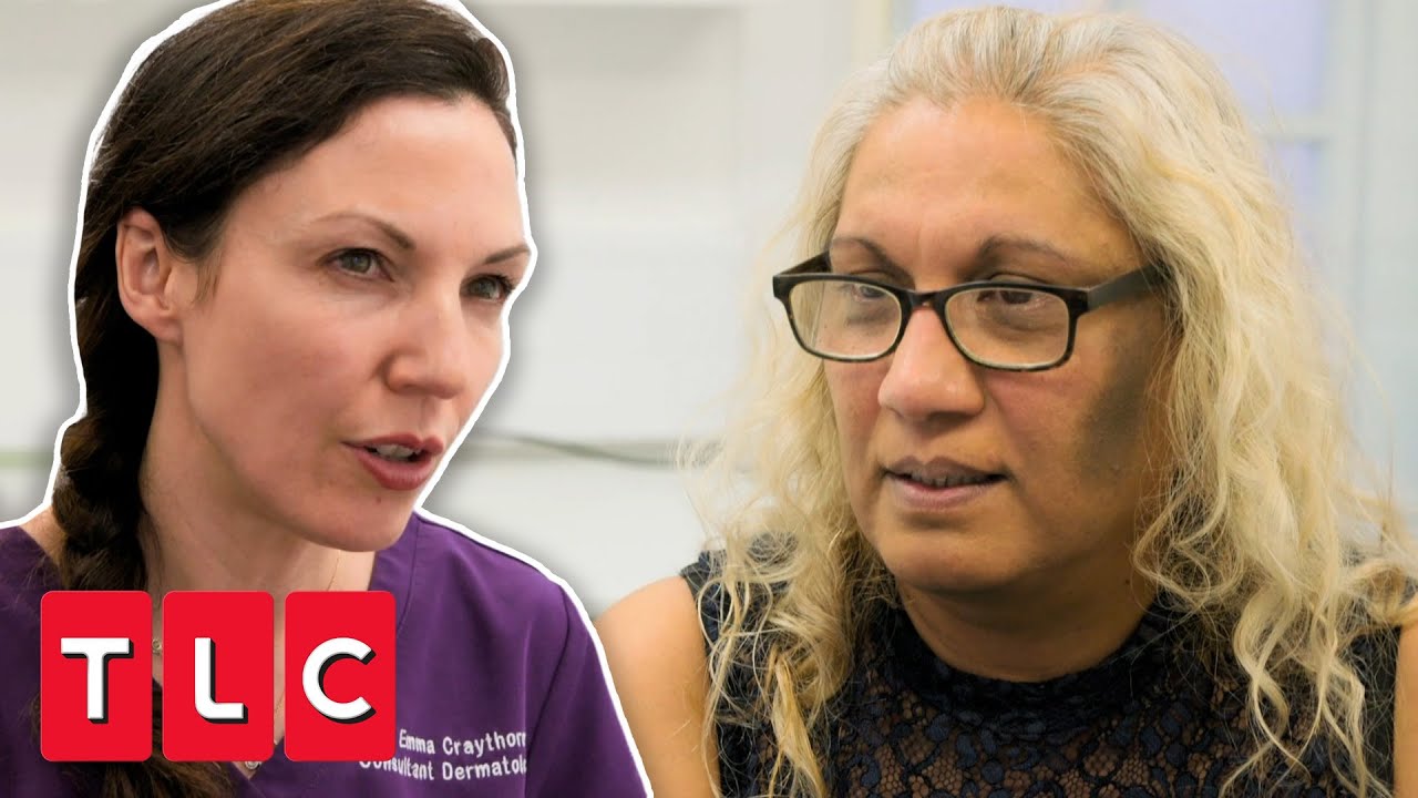 Diabetes Is The Reason For This Woman's Dark Patches On Her Face | Bad Skin Clinic