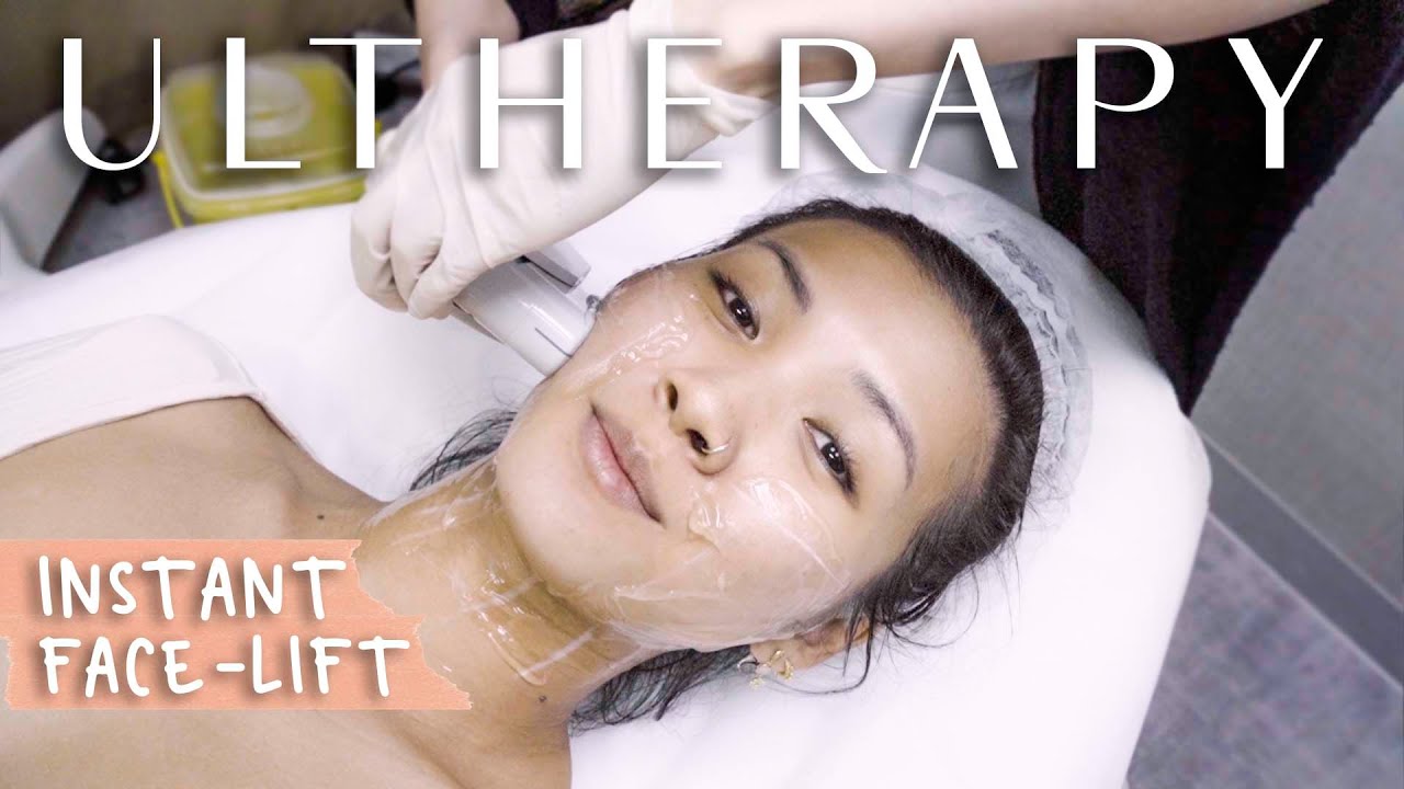 Ultherapy | The Process | A Play-By-Play