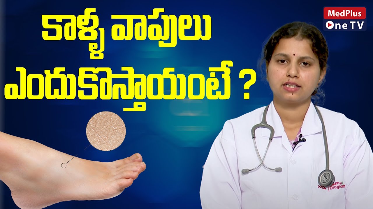 Pedal Edema Causes and Symptoms | Dr.Jyothirmayi Tangirala @MedPlusONETV
