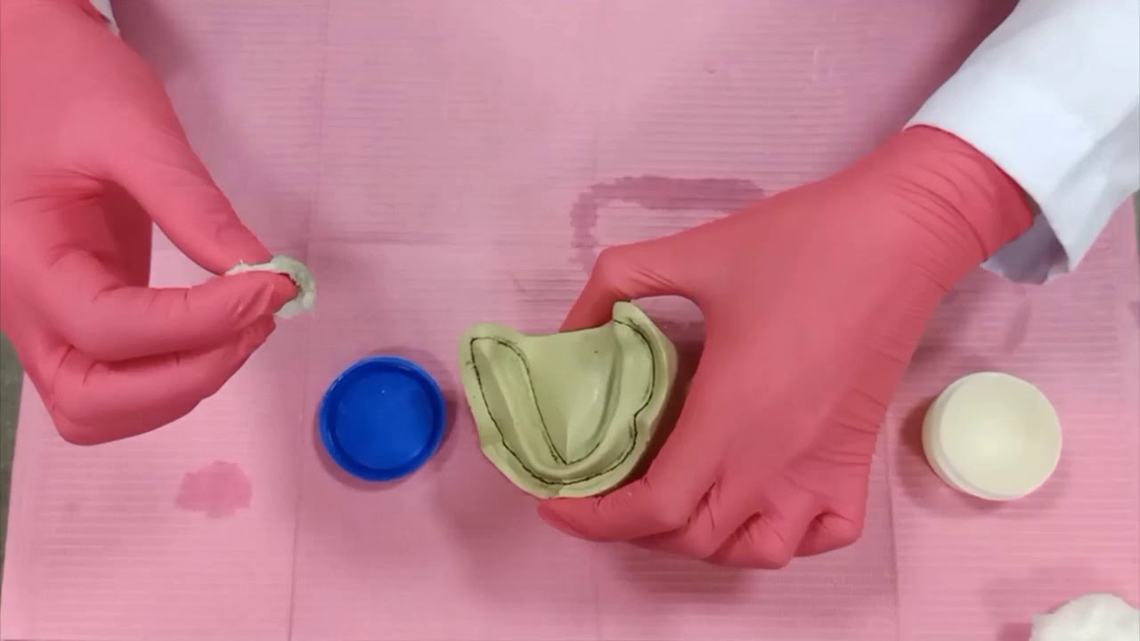 Special tray construction for edentulous archs (part 1)
