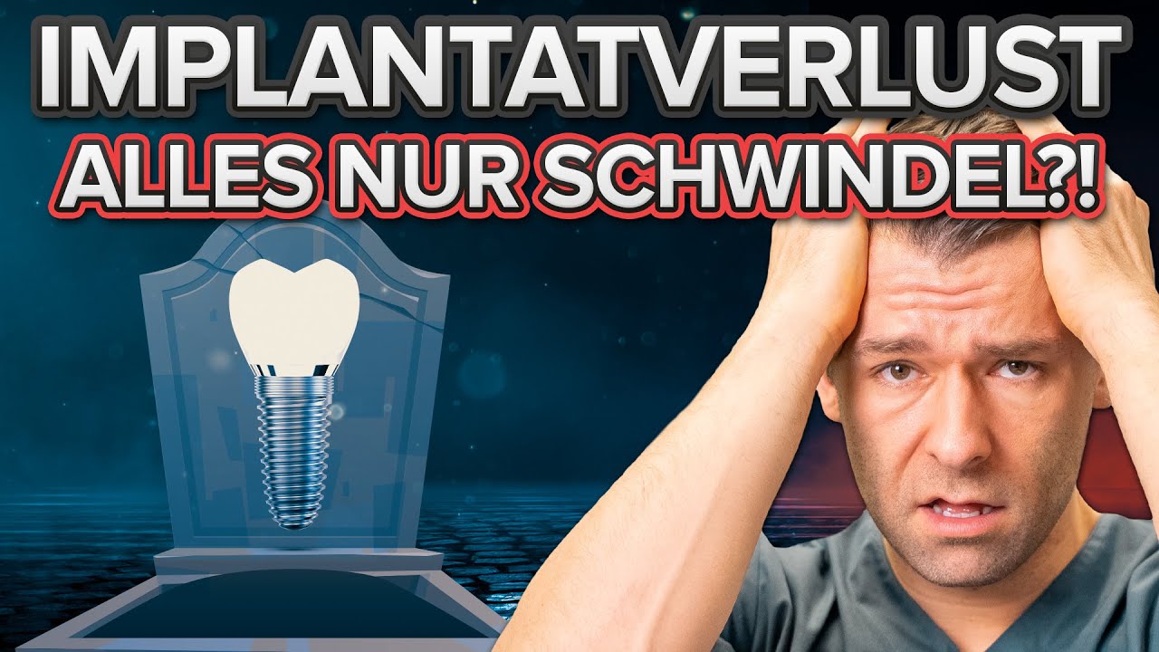 Überlebensraten bei Implantaten - Die Gesamte Wahrheit inkl. Studienergebnissen