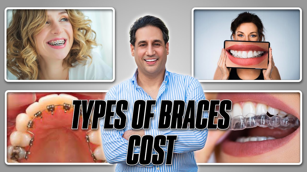 Types of Braces | Which is Right For You? | Orthodontic Treatment Price in Pakistan