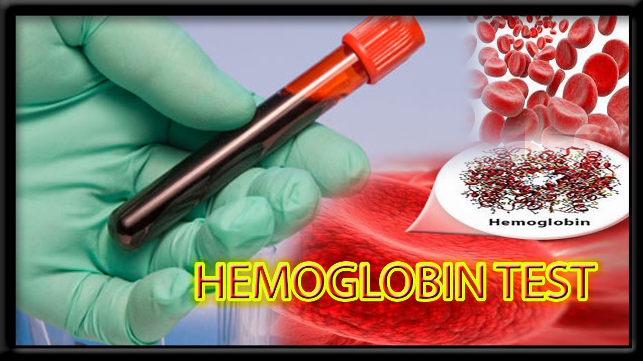 Hemoglobin Blood test # HGP | # Harib diagnostic lab