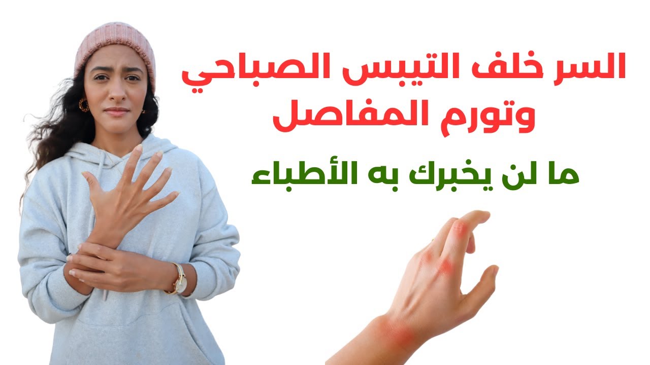علاج التيبس الصباحي بدون أدوية / أسرار علاج التهاب المفاصل الروماتويدي