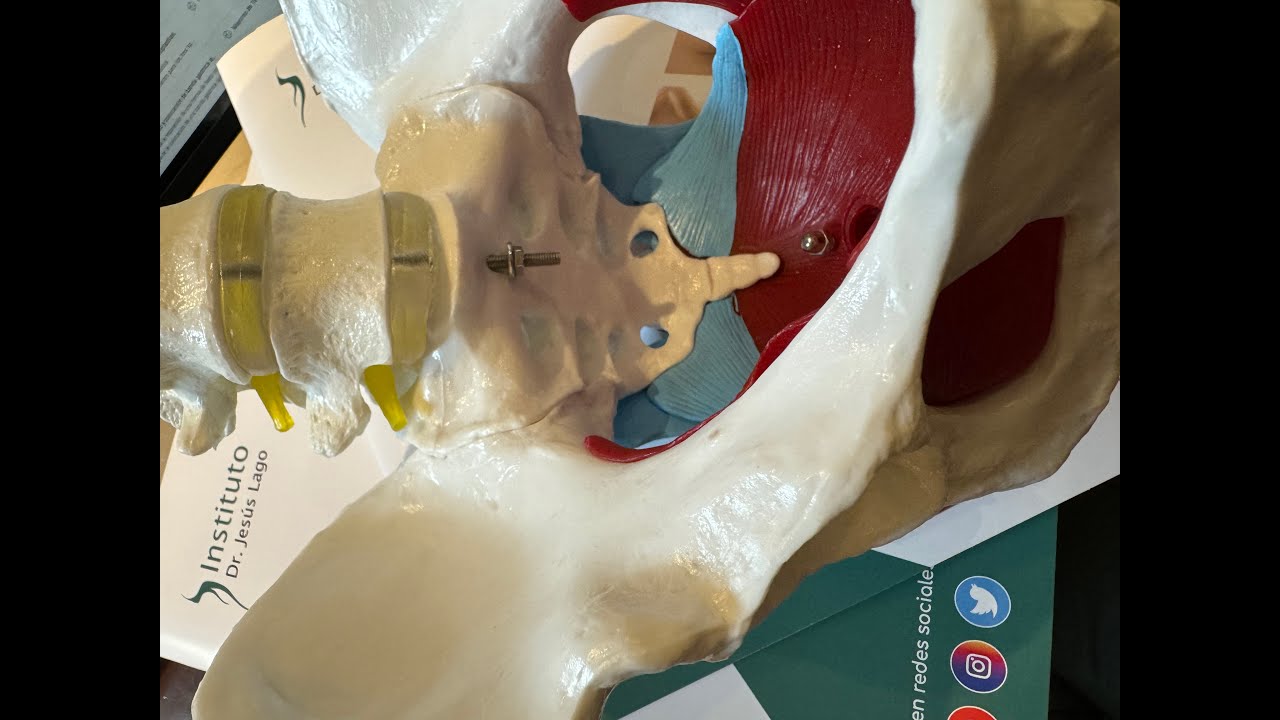 En Español, cómo realizar las dilataciones después de la vaginoplastia