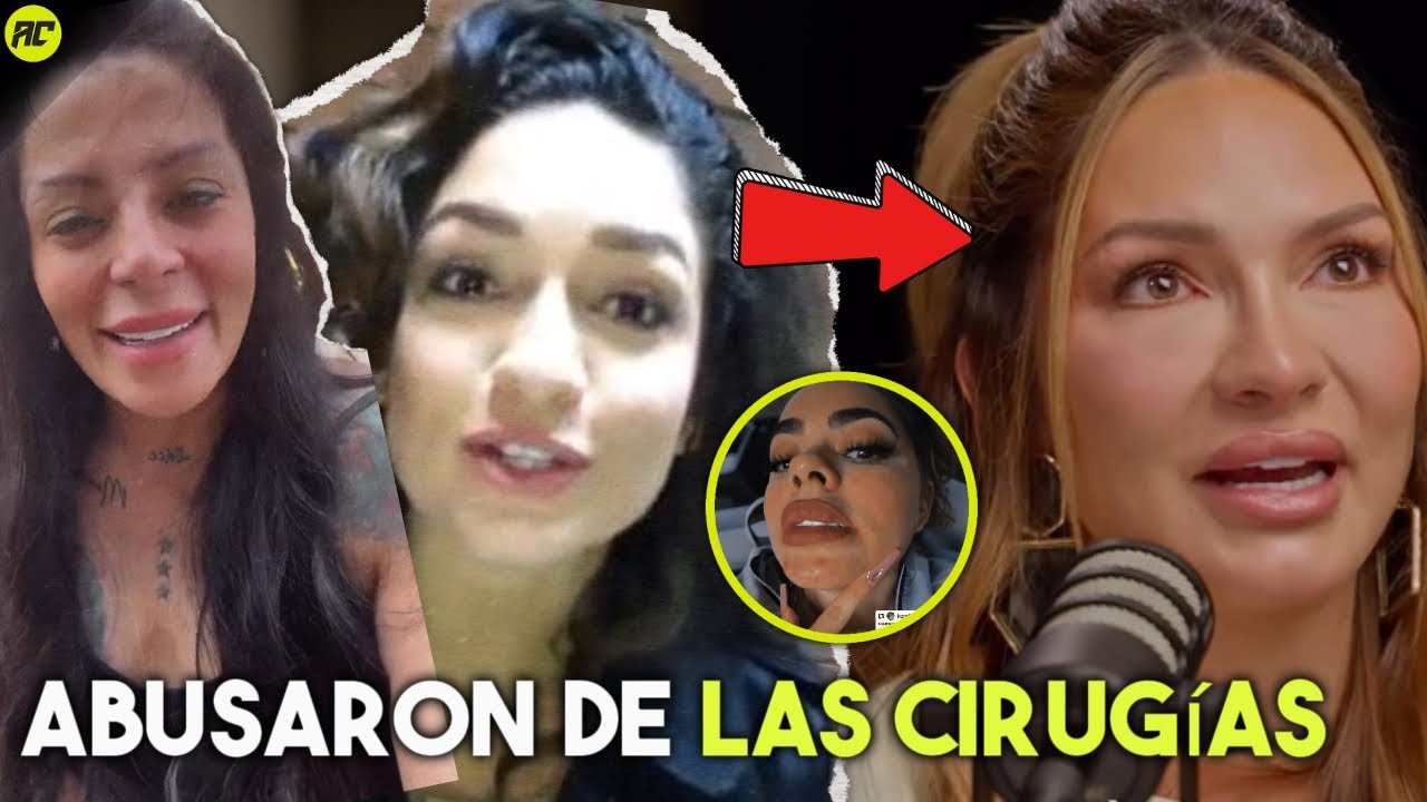 6 Famosas Colombianas que Arruinaron su Belleza por las Cirug&iacute;as.