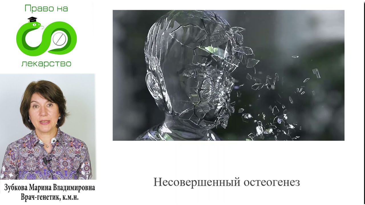 016 Несовершенный остеогенез