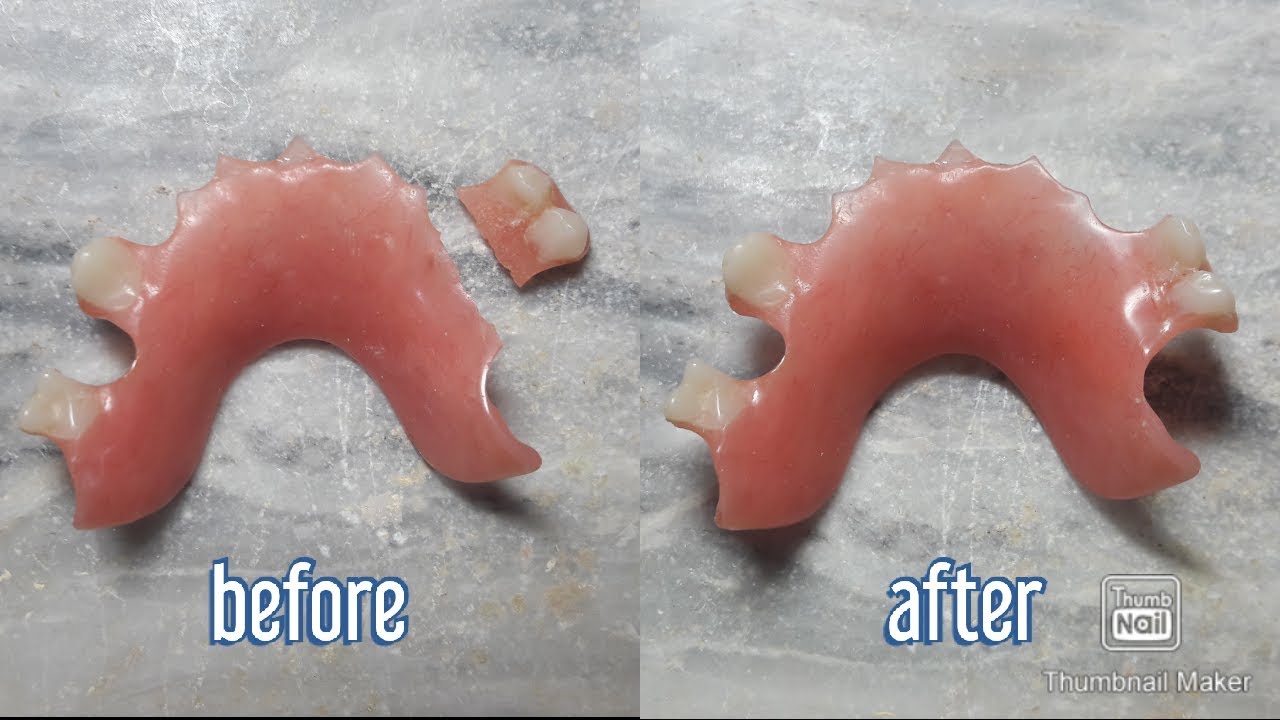 How to fix a broken denture