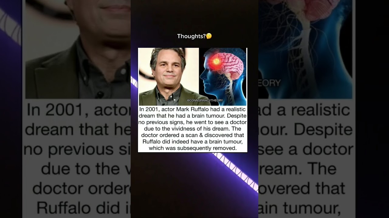 Mark Ruffalo brain tumor Thoughts? #markruffalo #braintumor