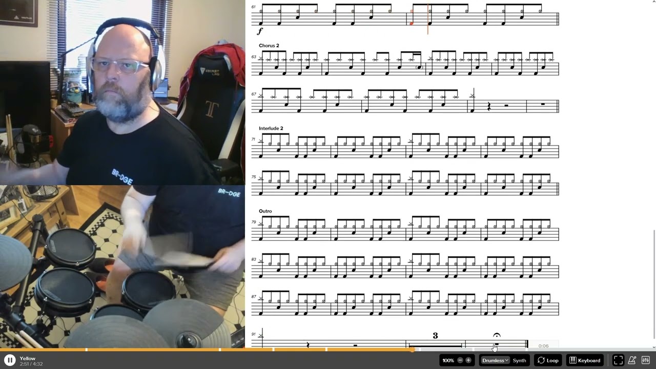 Coldplay - Yellow Drums #edrum #drumeo #newbie #begginers #drummer