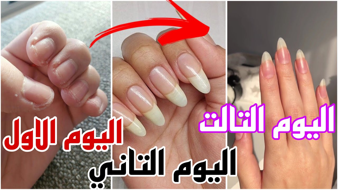 ازاي طولت اظافري في 3 ايام فقط قبل العيد بمكونتين في البيت | 3 وصفات دمار💅🏻