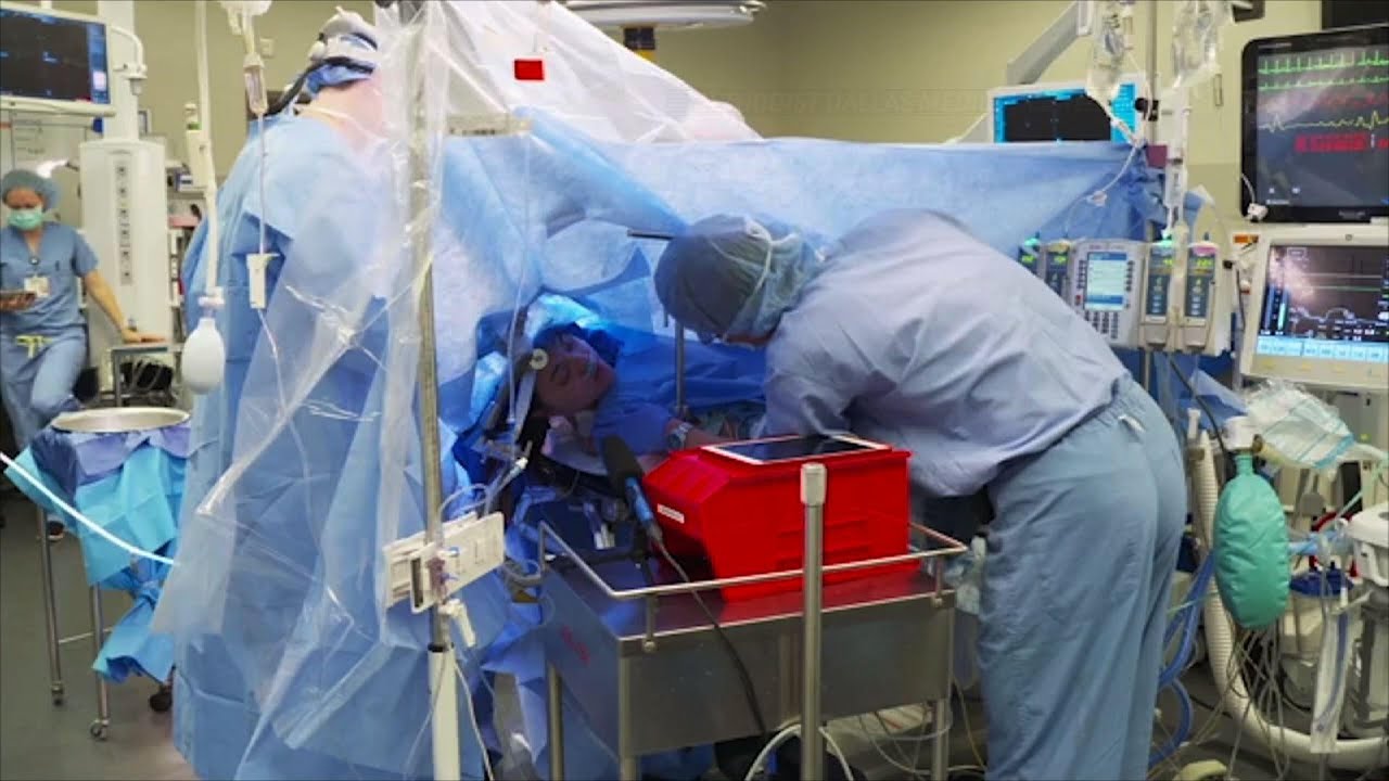 Awake brain surgery livestreamed on Facebook