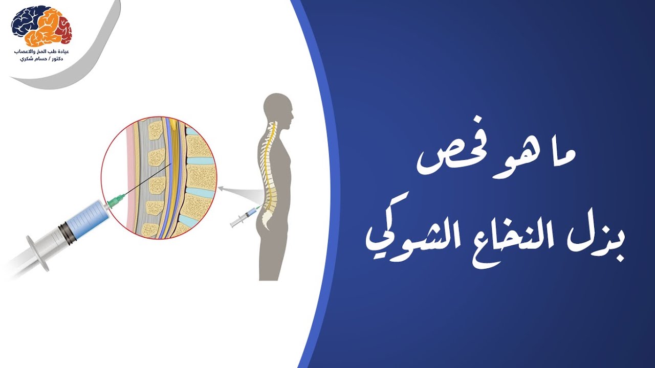 ما هو فحص بذل النخاع الشوكي
