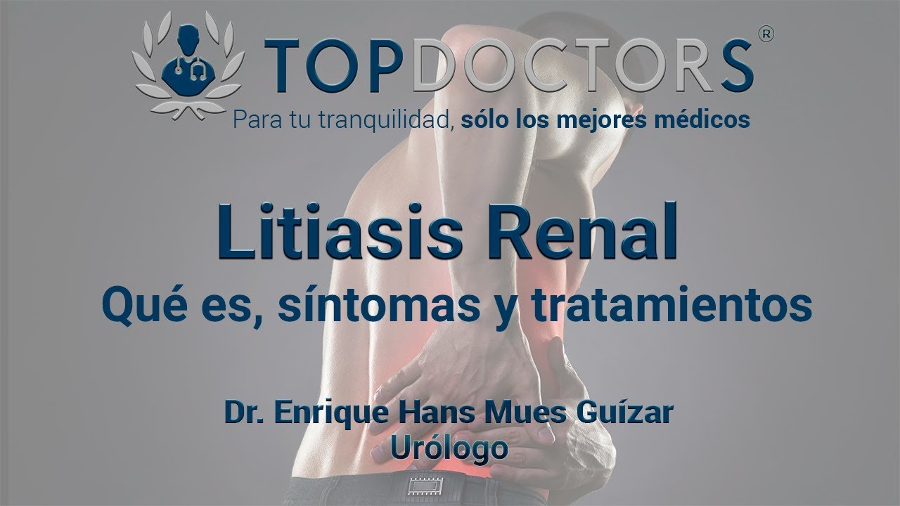 ¿Qué es la litiasis renal? Conoce todos los detalles