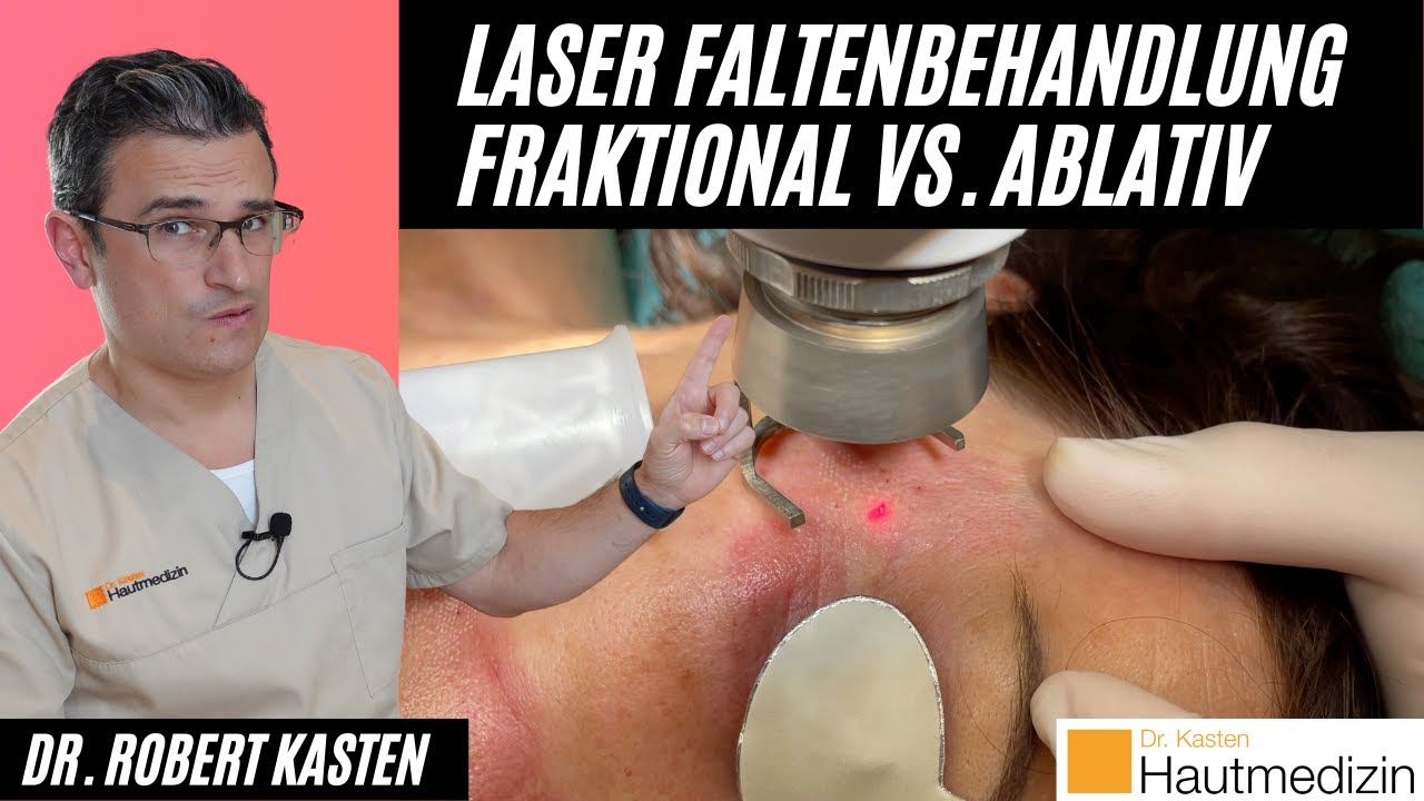 Laser Faltenbehandlung: Fraktioniert vs. Ablativ vs. Radiofrequenz-Mikroneedling. Hautarzt erkl&auml;rt