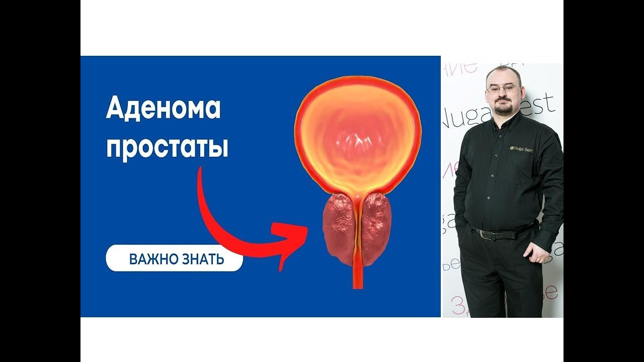 Аденома простаты