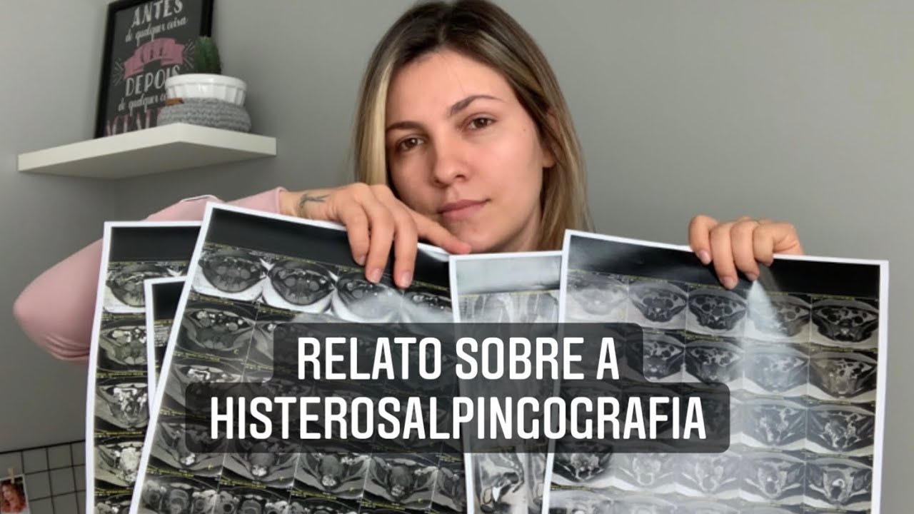Meu relato sobre o exame de HISTEROSALPINGOGRAFIA