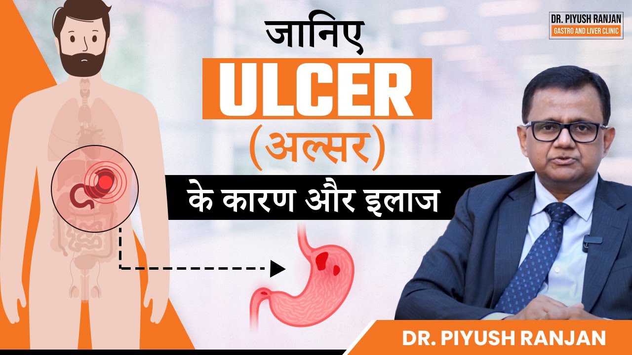 जानिए Wrz&oacute;d (अल्सर) क्यों होता है और इलाज क्या है? | Leczenie wrzod&oacute;w dwunastnicy i żołądka