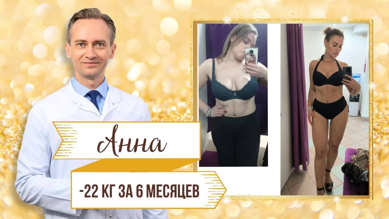 Анна -22 кг за 6 месяцев. Как 