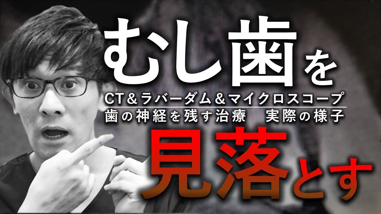 【見えないむし歯？】見落とす？　歯の神経を残す治療ダイジェスト　＃MTA　＃マイクロスコープ　＃MICROSCOPE　＃CT　＃歯の神経を残す　＃覆髄法
