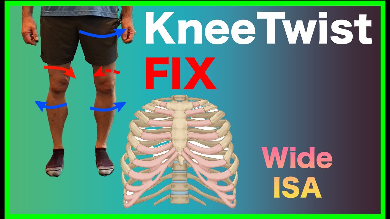 Have Knee Pain? Untwist It | Wide Infrasternal Angle Case