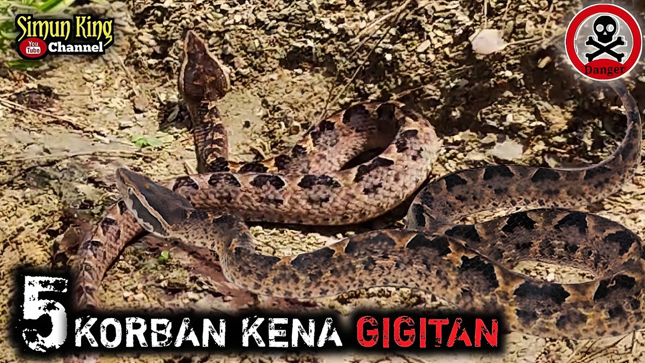 5 Orang Korban Kena Gigitan Ular Gibug