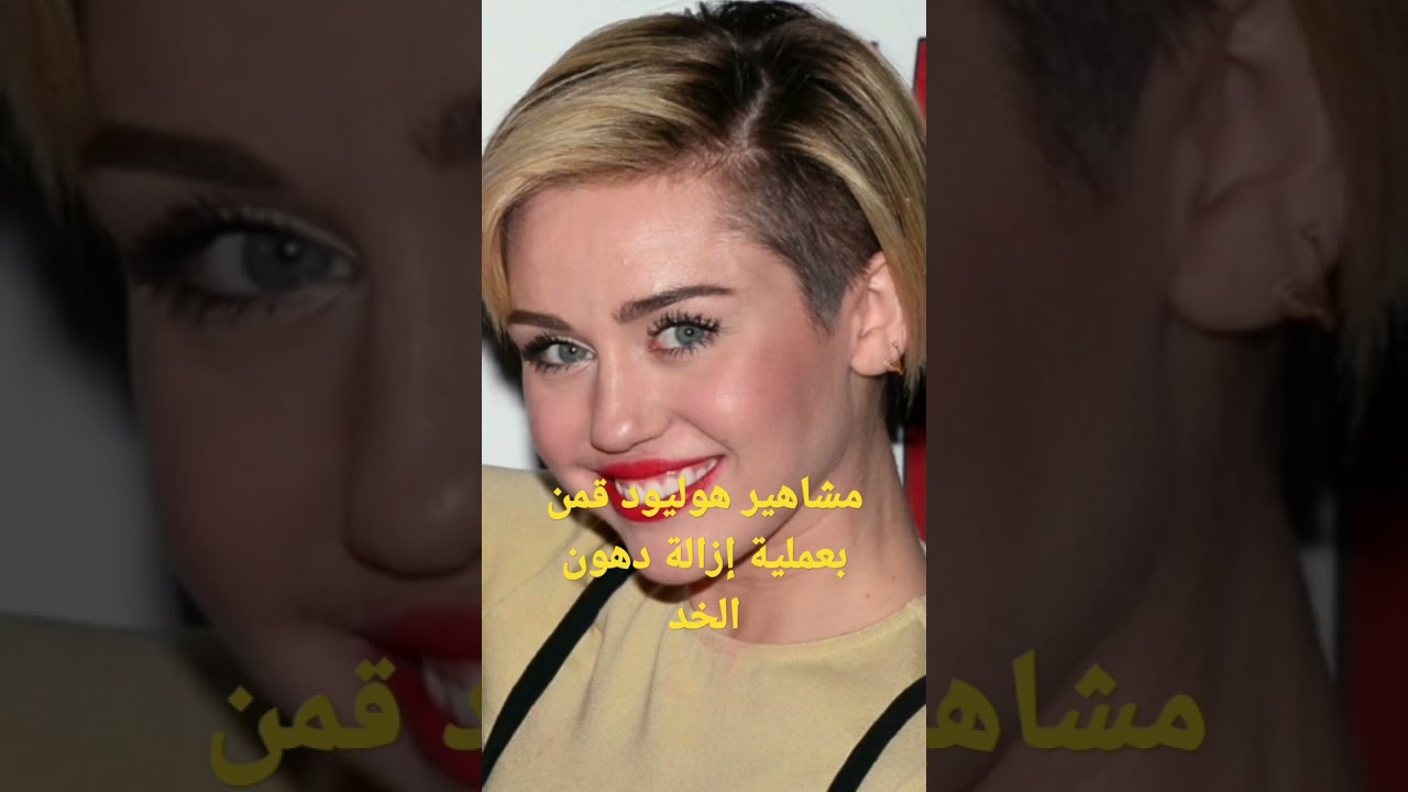مشاهير هوليود قبل و بعد  تقنية إزالة دهون الخد #شورت