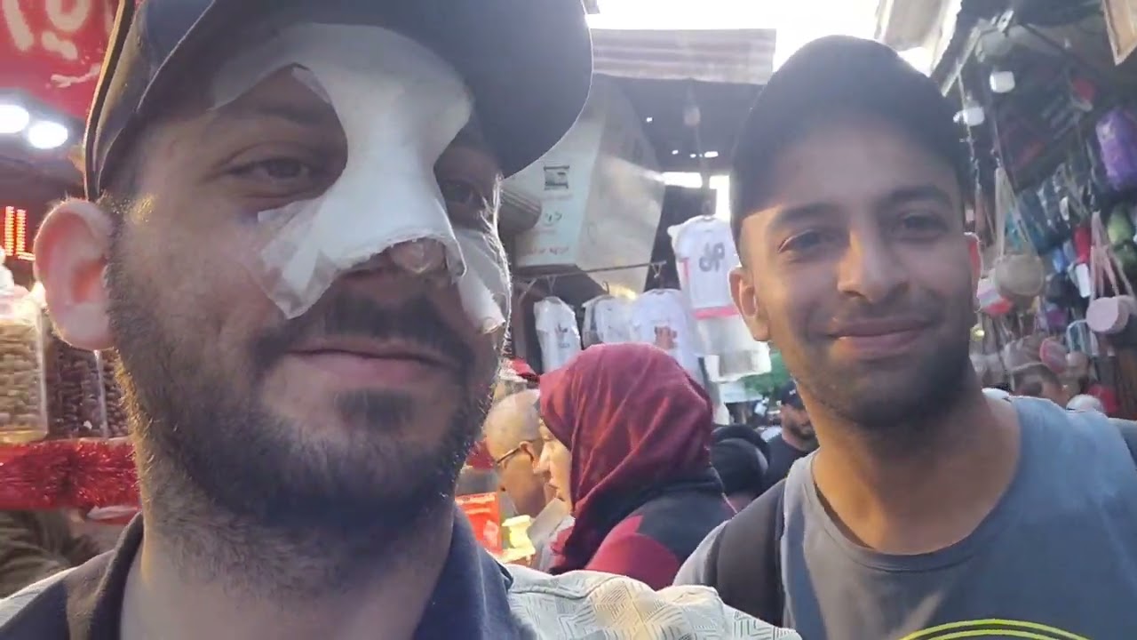 عملية الانف في سوريا تاريخ 05.05.2022
