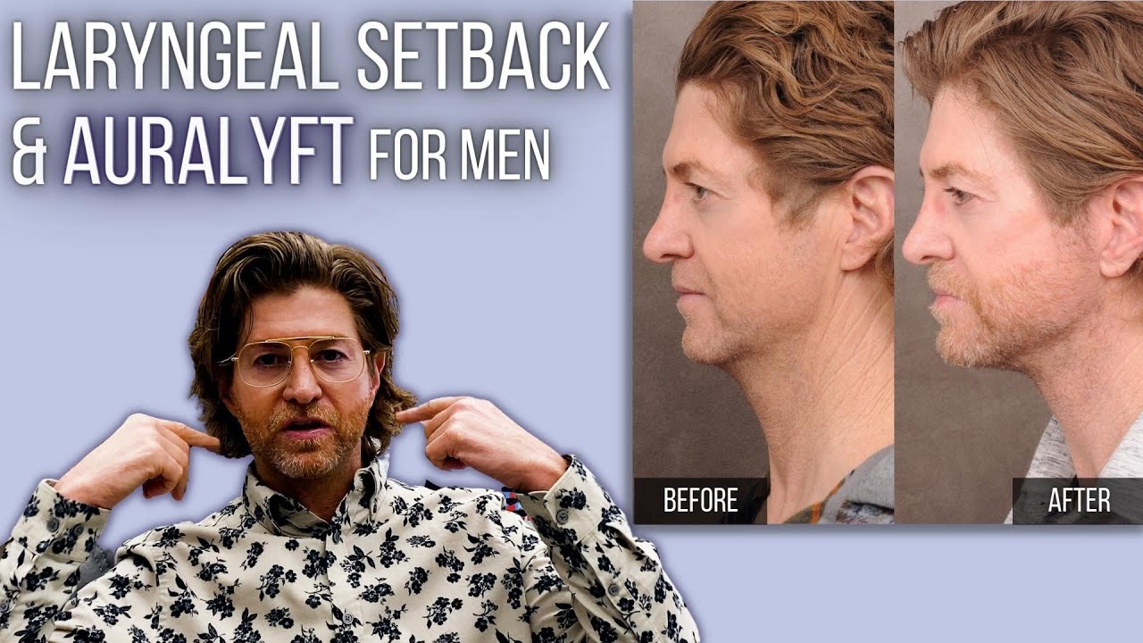 Laryngeal Setback and AuraLyft for Men | Dr. Ben Talei | Beverly Hills Center for Plastic Surgery