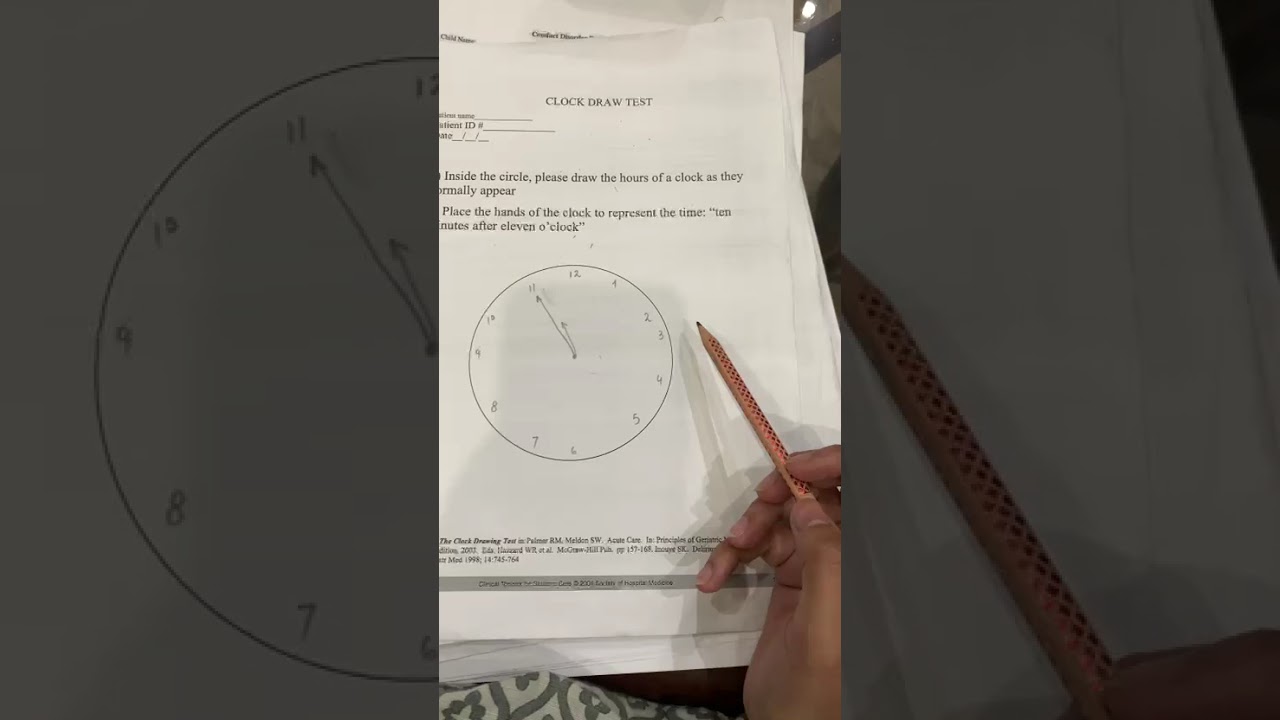 The Clock Draw Test(Neurological)
