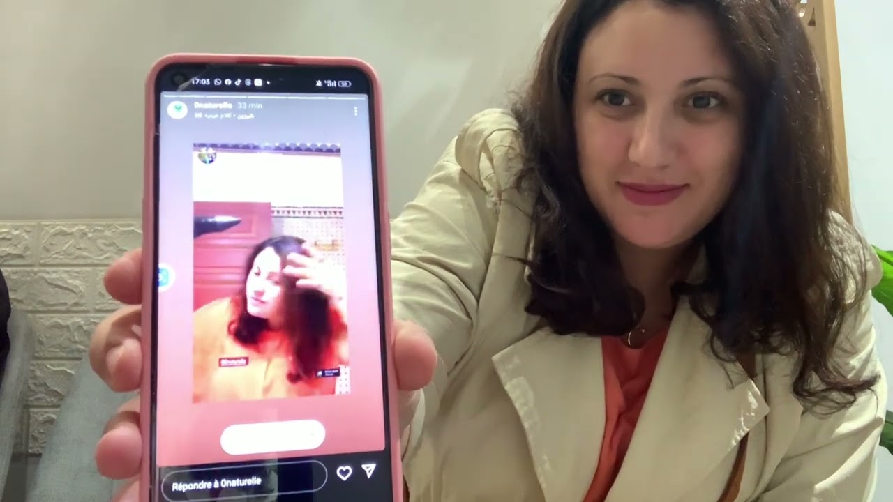 و اخيرا درت Microblinding .. .بغيت رأيكم