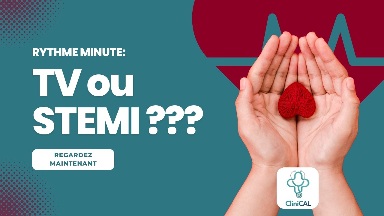 Tachycardie Ventriculaire ou STEMI ???