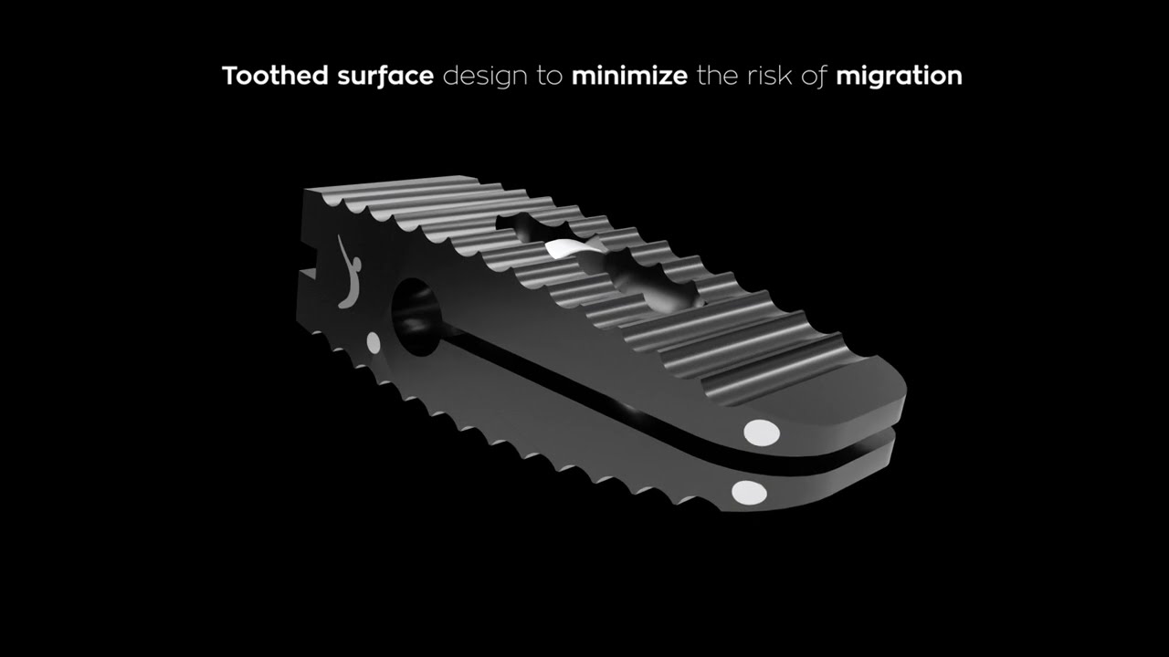 PROCAYMAN™ - Expandable PLIF PEEK Cage