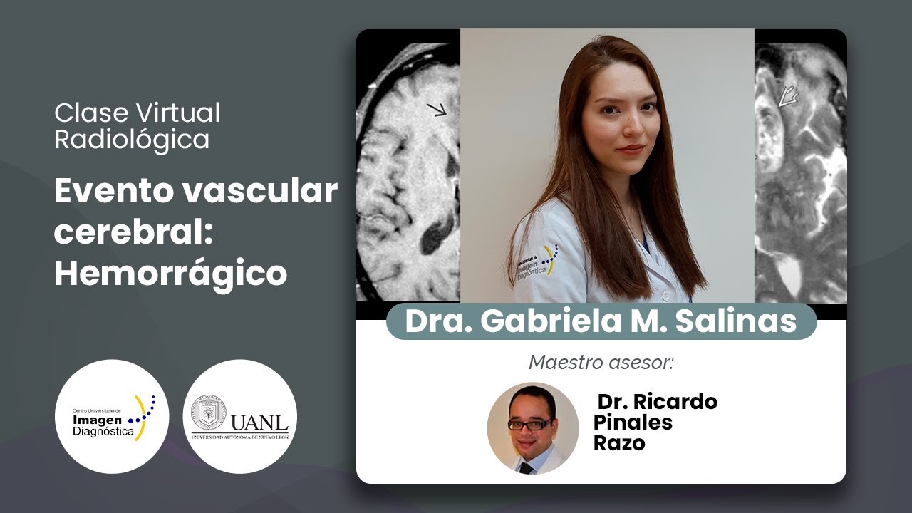 Evento vascular cerebral: Hemorr&aacute;gico por la Dra. Gabriela Salinas