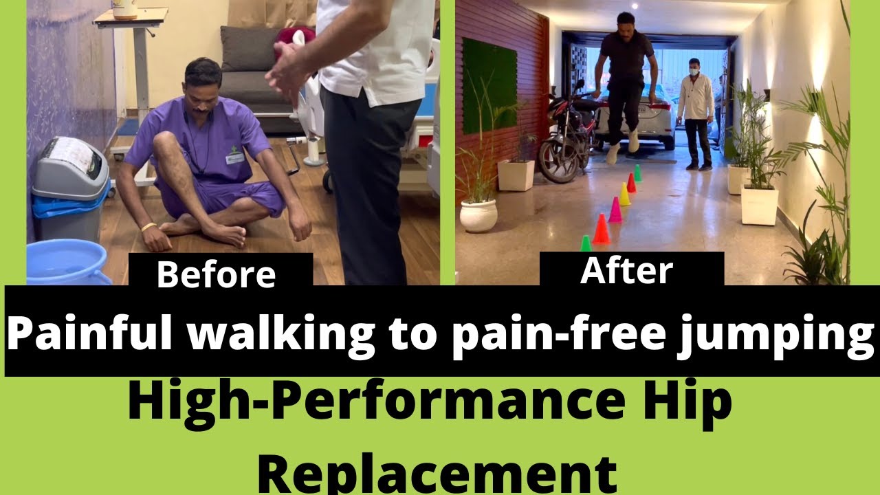 High performance Hip replacement in Delhi, India /हाई परफॉरमेंस हिप रिप्लेसमेंट ऑपरेशन दिल्ली में