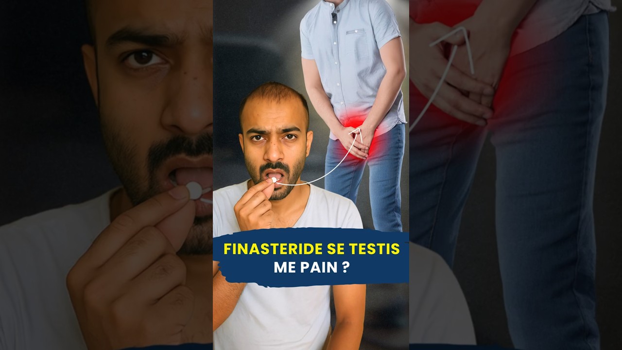 Finsateride side effect | Hair Growth | Hair Care | Hair Expert | Waidon