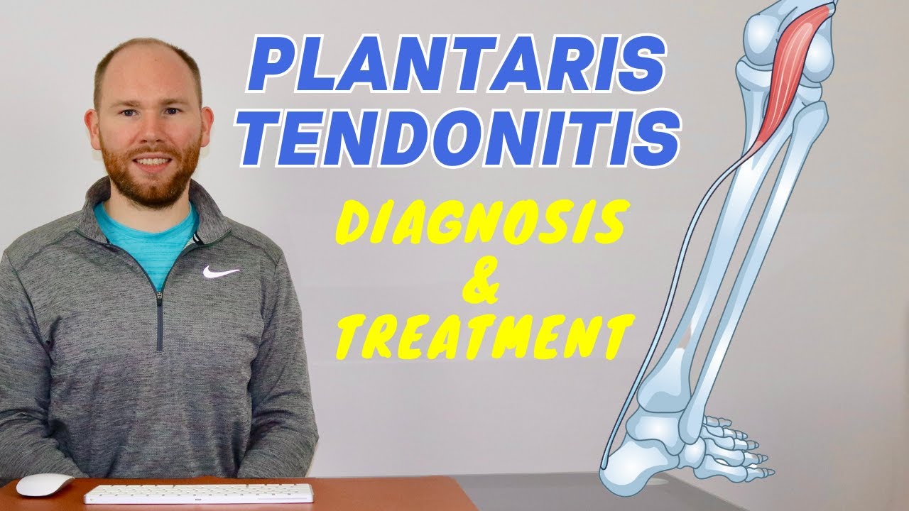 Plantaris Muscle Pain | Plantaris Rupture and Plantaris Tendonitis