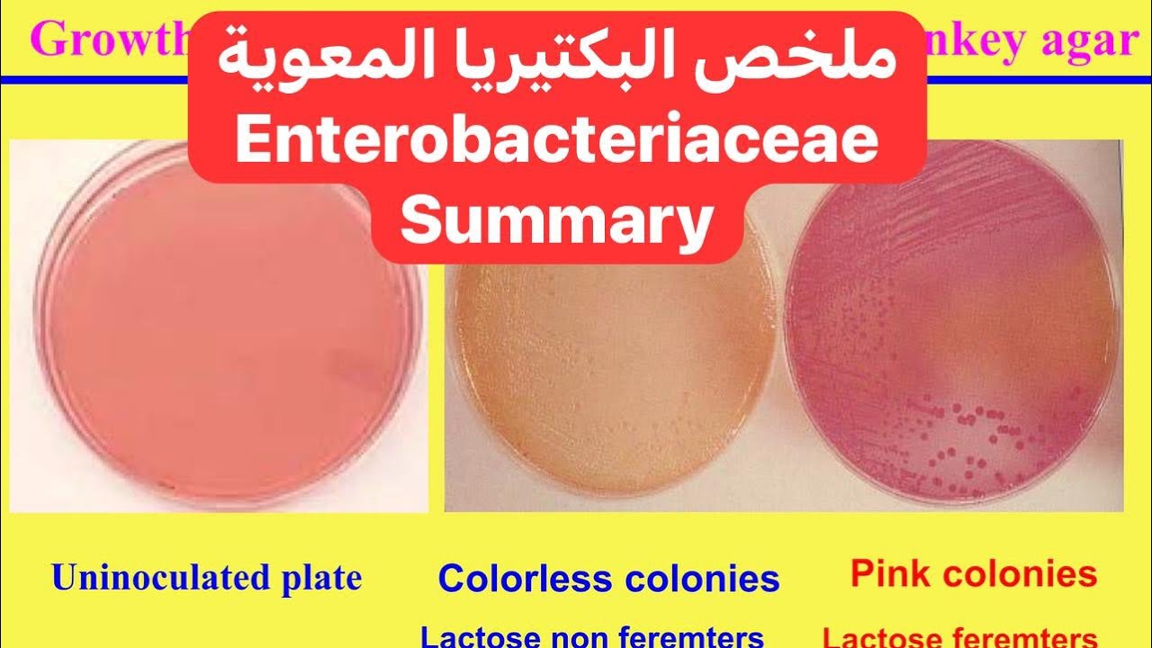 ملخص البكتيريا المعوية Enterobacteriaceae Summary