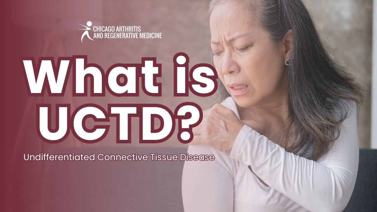 What is Undifferentiated Connective Tissue Disease? Symptoms, Causes, and Treatment Explained.