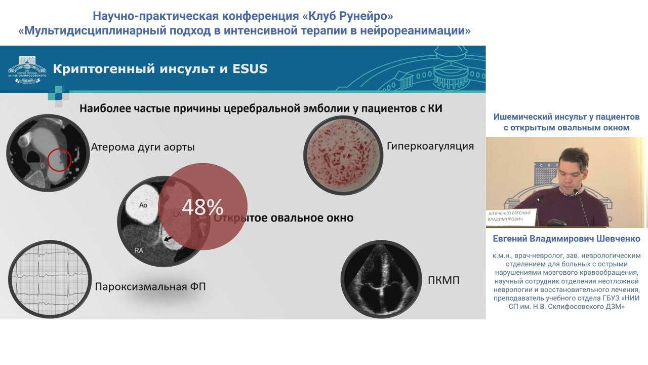 Ишемический инсульт у пациентов с открытым овальным окном